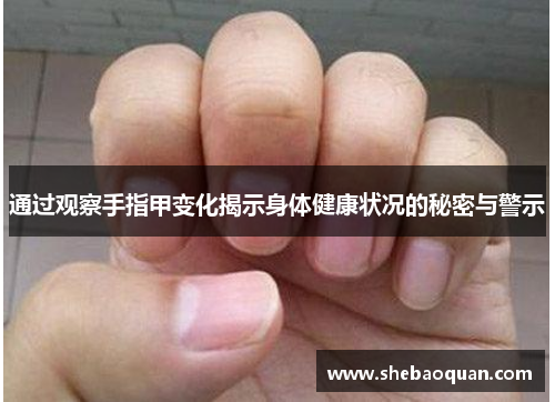 通过观察手指甲变化揭示身体健康状况的秘密与警示 通过观察手指甲变化揭示身体健康状况的秘密与警示