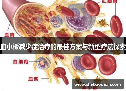 血小板减少症治疗的最佳方案与新型疗法探索